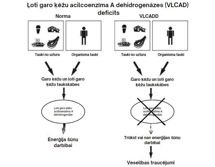 Ļoti garo ķēžu acilkoenzīma A dehidrogenāzes deficīts (VLCADD)