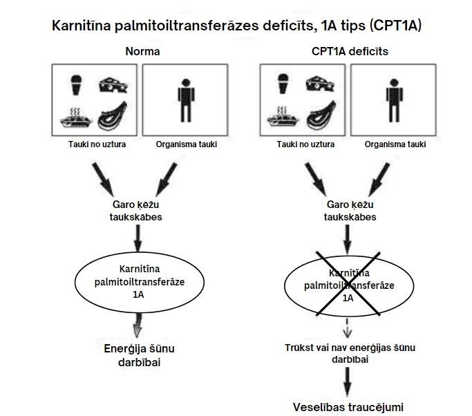 Karnitīna palmitoiltransferāzes deficīts, 1A tips