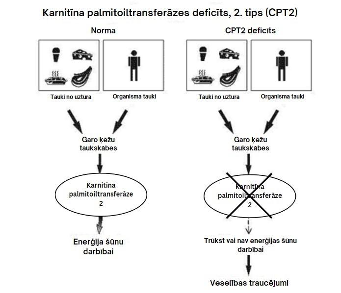 Karnitīna palmitoiltransferāzes deficīts, 2.tips (CPT2 deficīts)