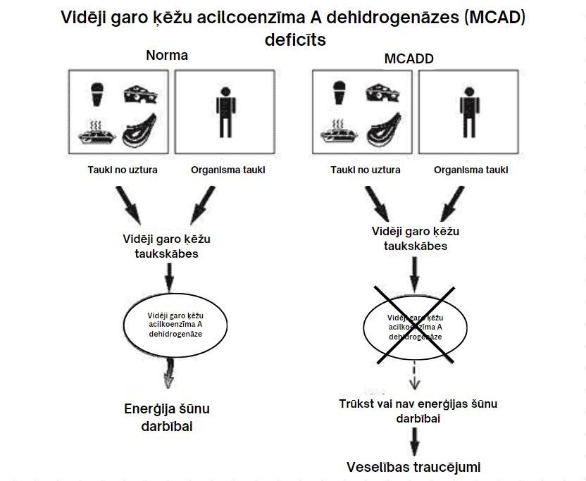 Vidēji garo ķēžu acilkoenzīma A dehidrogenāzes deficīts (MCADD)